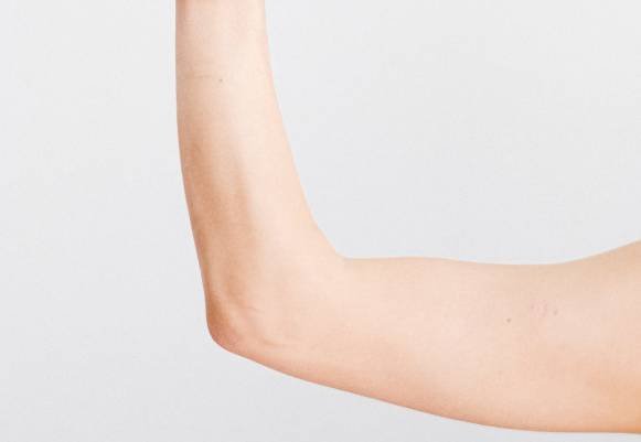 Arm Liposuction in Delhi