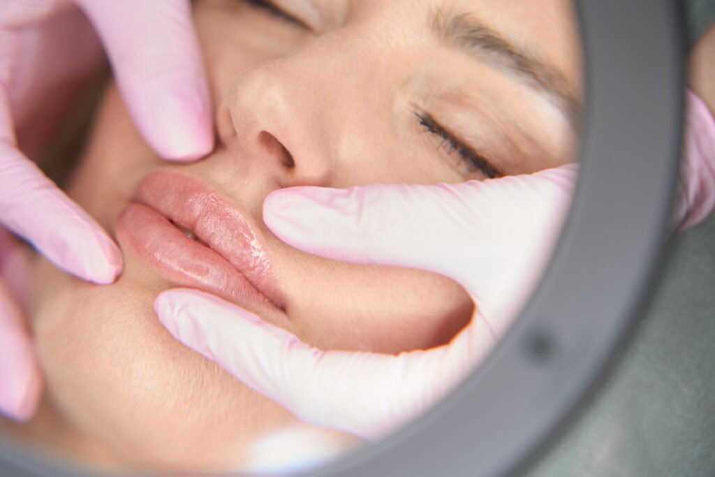 lip fillers in delhi, india